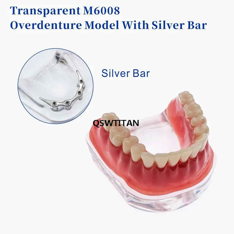 Repair teeth implant model with Silver Bar Denture Teeth mandibular model Dental Teaching Model