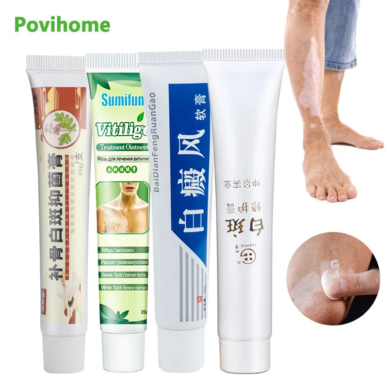 

4Types Vitiligo Treament Cream White Spot Antibacterial Ointment Leukoplakia Skin Melanin Deposition Health Care Medical Plaster