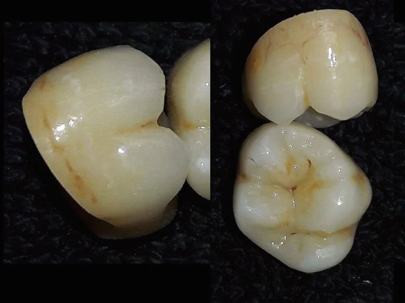 Beautyzir Dental Lab زركونيا جليز كلاسيك (1 زجاجة) 16 لونًا مواد زجاجية #3