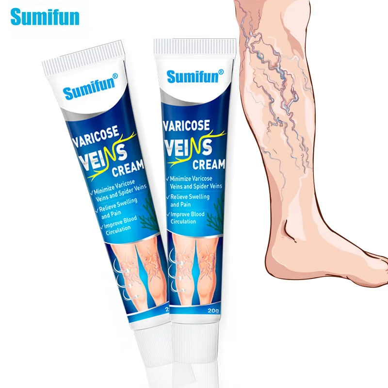 Sumifun 1pcs Vasculitis Phlebitis Spider Cream Varicose Veins Treatment Cream Varicosity Angiitis Removal Medical Plaster P1234