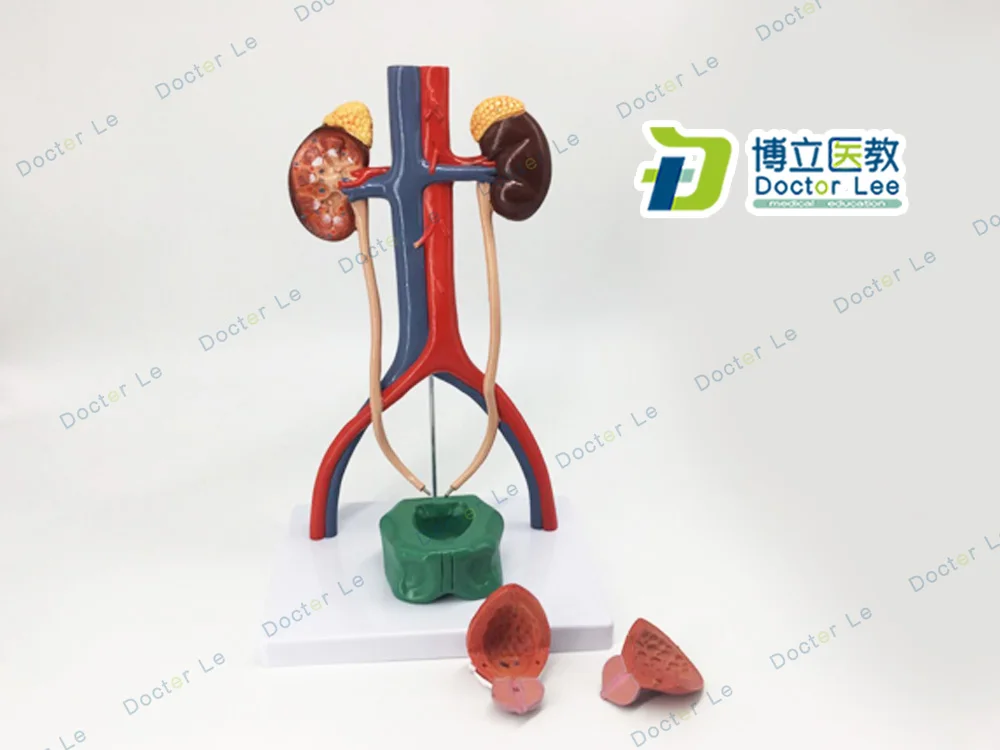 Human Urinary System Anatomical Model Kidney Ureter Bladder Urethra Anatomical Model Medicine Urology