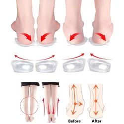 2Pcs Silicone Orthopedische Binnenzool Hiel Pad Voor Mannen Vrouwen X/O Been Voet Valgus Correctie Gezondheid Voetverzorging tool Gel Schoenen Kussen