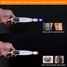 Laser Picosecond Pen for Tattoo and Pigment Removal #3