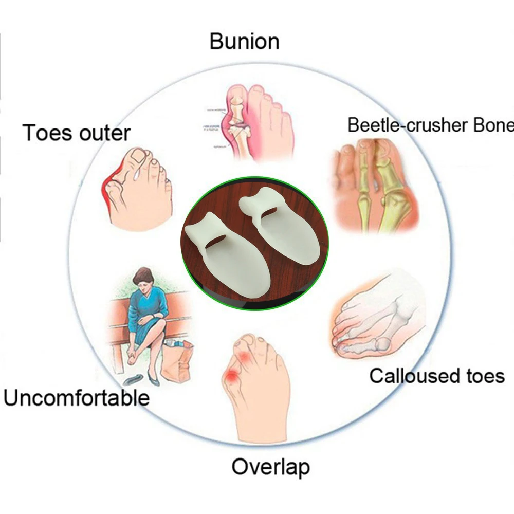 6 adet silikon jel halluks Valgus ortopedik koruyucu ayak bunyon ayırıcılar düzeltici başparmak ağrı kesici ayak pedikür aracı D2738