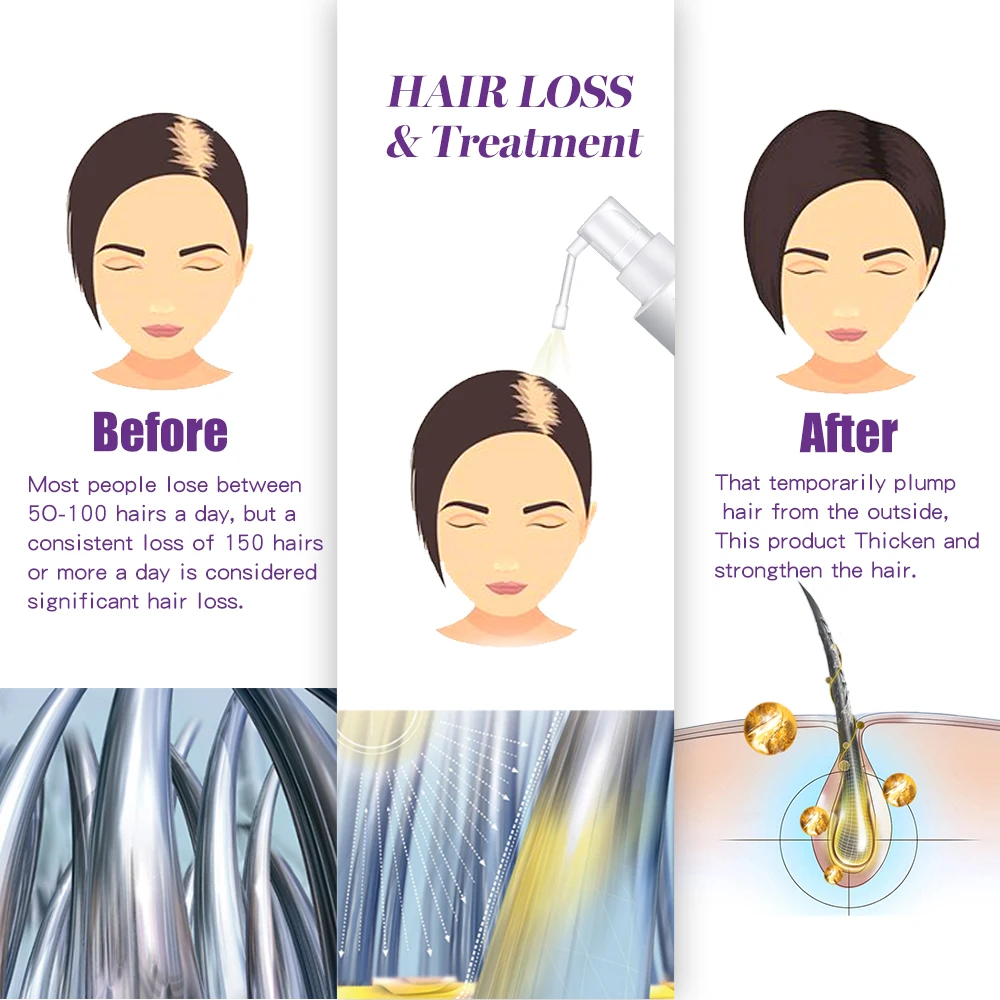 HAIRCUBE Hair Rapid Growth Essence Oil Anti Hair Loss Dense Hair Repair Damage Hair Serum Natural Organic Hair Care Spray