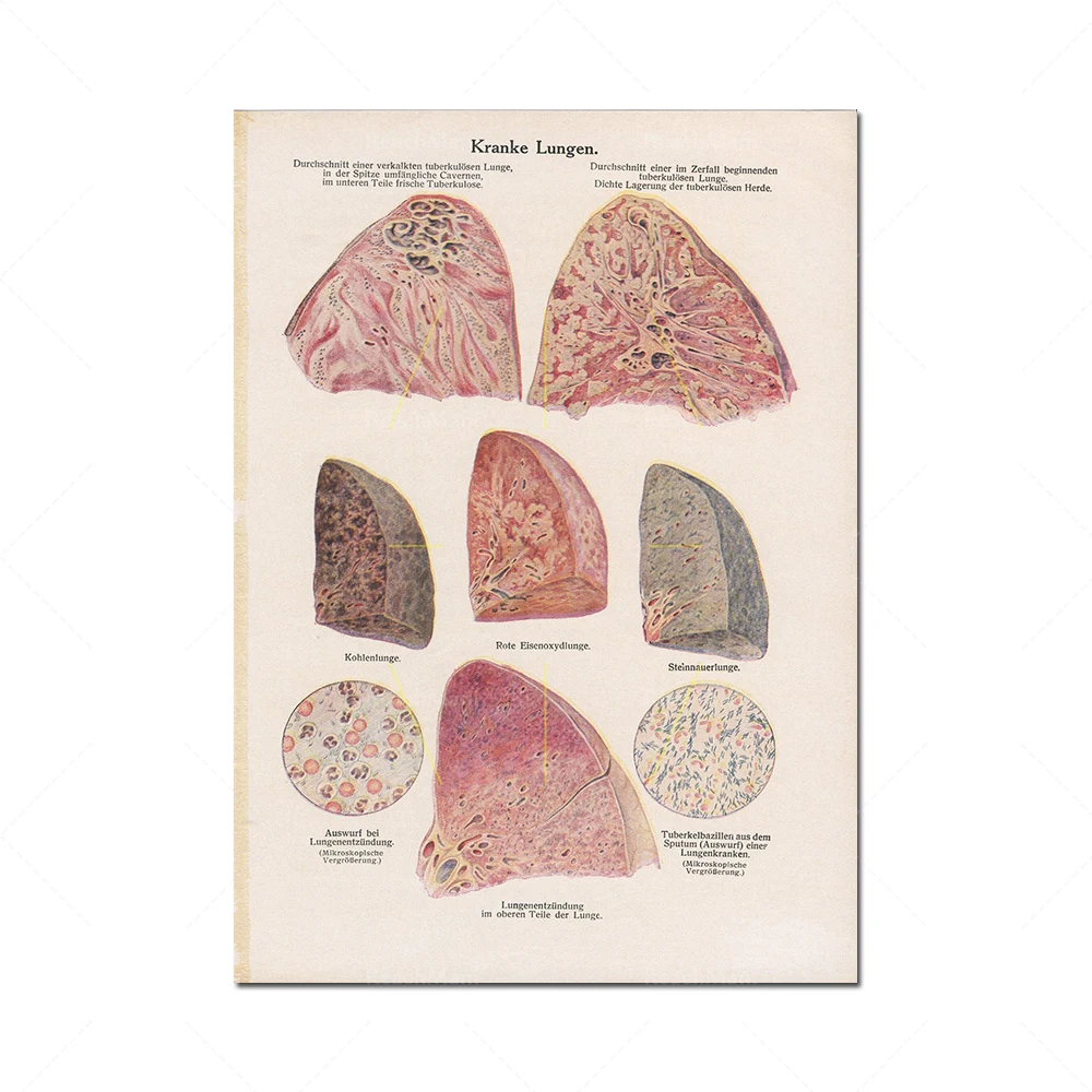 Doctor patent printing, brain, hand, foot, muscular system anatomical structure anatomy printing, medical hospital art clinic wa