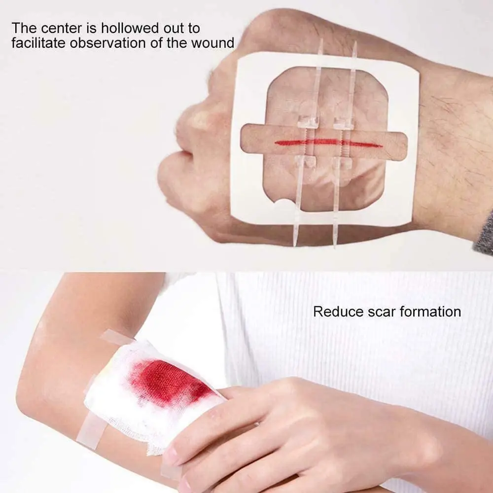 Adhesive Zipper Bandage Wound Closure Emergency Laceration Strips Without Suture for Survival Kit   Trauma Reduce Tension Scars