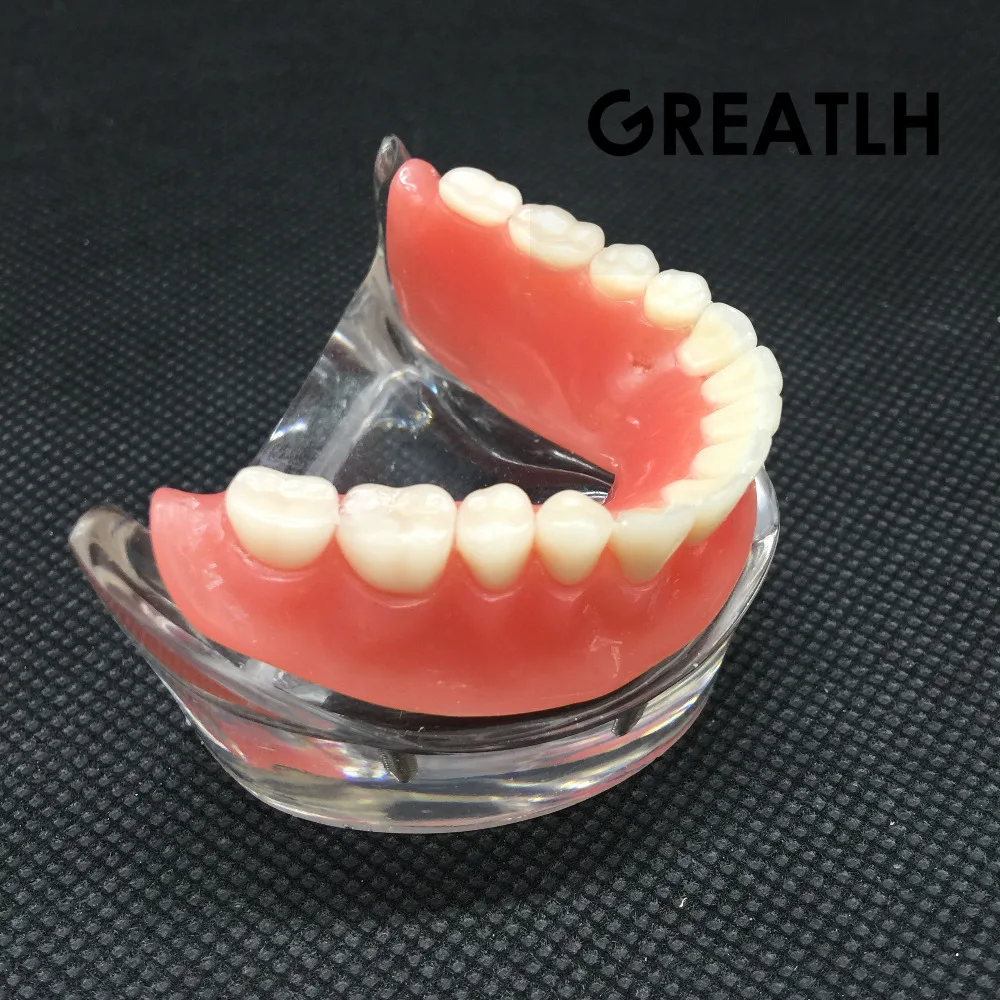 Nha Khoa Overdenture Nội Thất Mandibular Răng Hàm Dưới Mẫu Mandibular Với Giả Phục Hồi Răng Nha Khoa Giảng Dạy Học