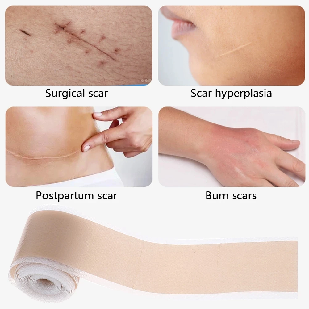 4x50cm Efficient Surgery Scar Removal Silicone Gel Tape Self Adhesive Therapy Patch for Acne Trauma Burn Scar Skin Repair