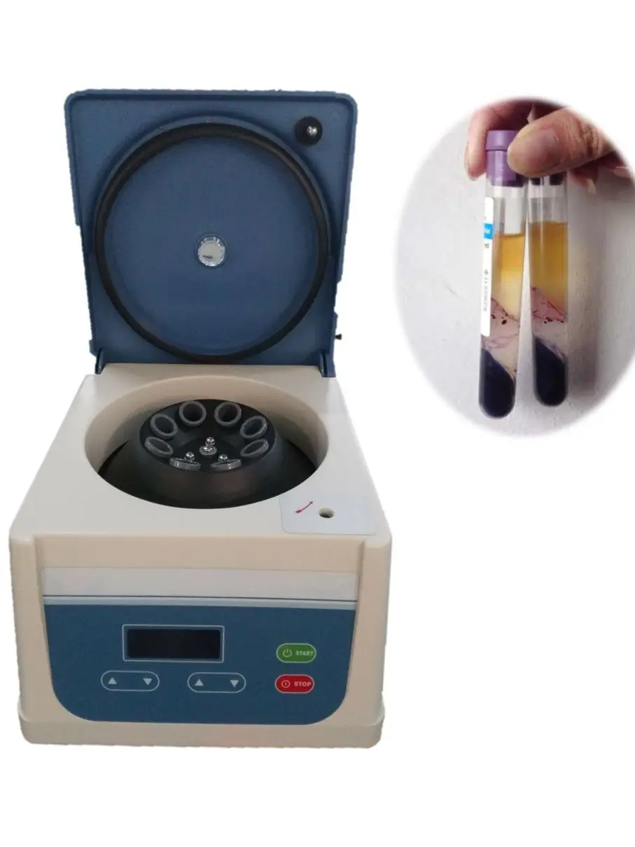 

2023 PRP Centrifuge with Angle Rotor 8x15ml 100pcs Platenet Rich Plasma Tube Activator in SPA Beauty Center Clinical Hospital