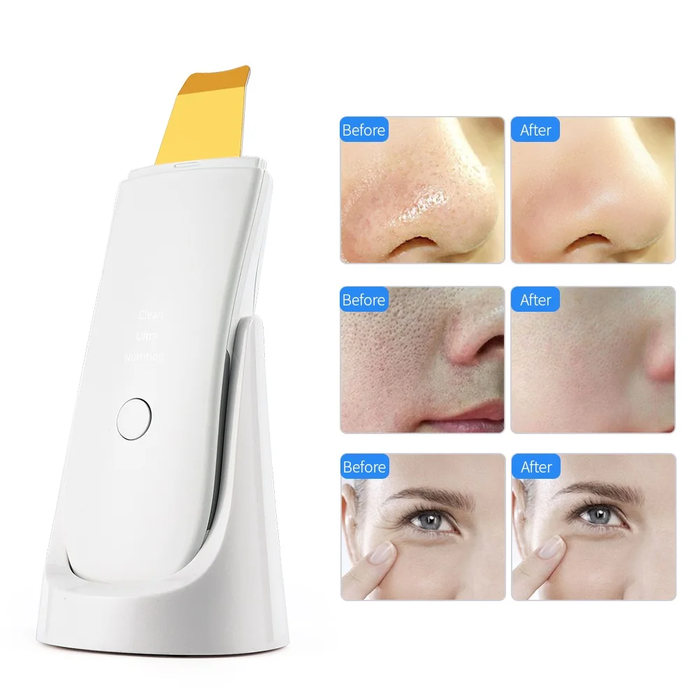 Purificador ultrassônico da pele do ouro 24khz do líquido de limpeza dos poros da acne & com a névoa nano que hidrata a máquina esfoliante de peeling facial