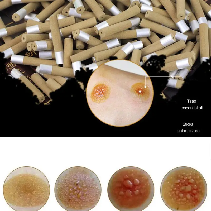 

10Pcs/Box 10Pcs/Box 35x7mm Five Years Old Thick Moxa Rolls Chinese Traditional Roller Stick Burner With Foil Moxibustion Massage
