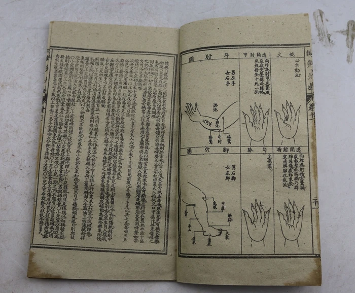 Chinese ancient thread book, drawing acupuncture and moxibustion Dacheng, a total of 12 books.