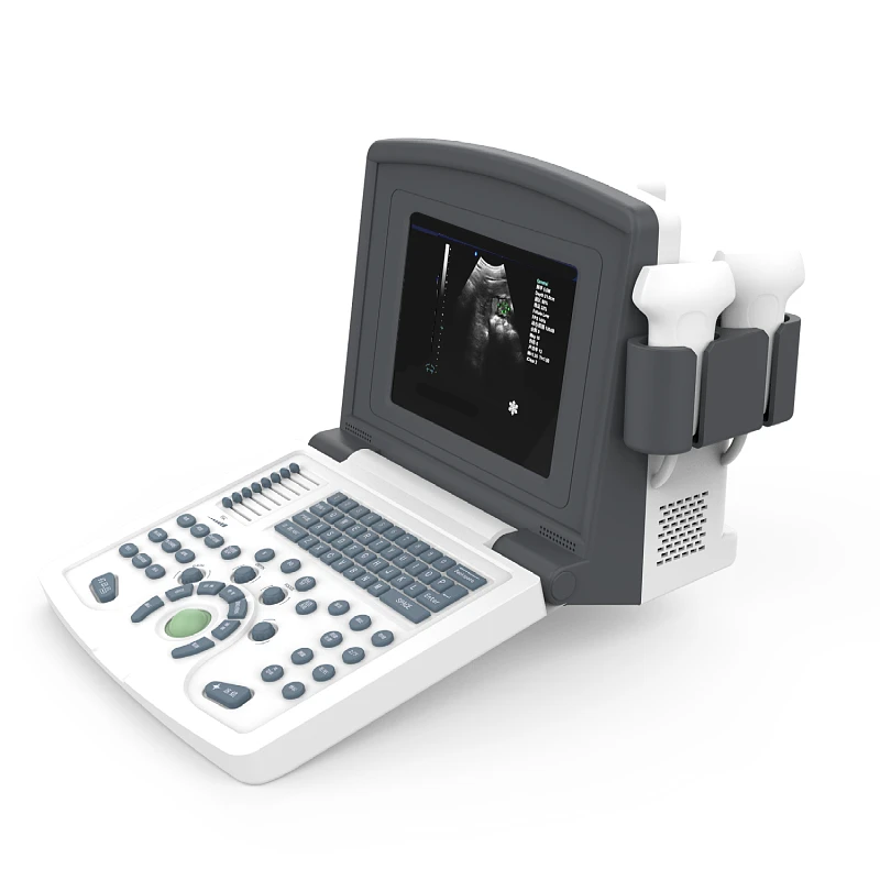 New Black And White Diagnostic Portable Ultrasound Scanner Machine