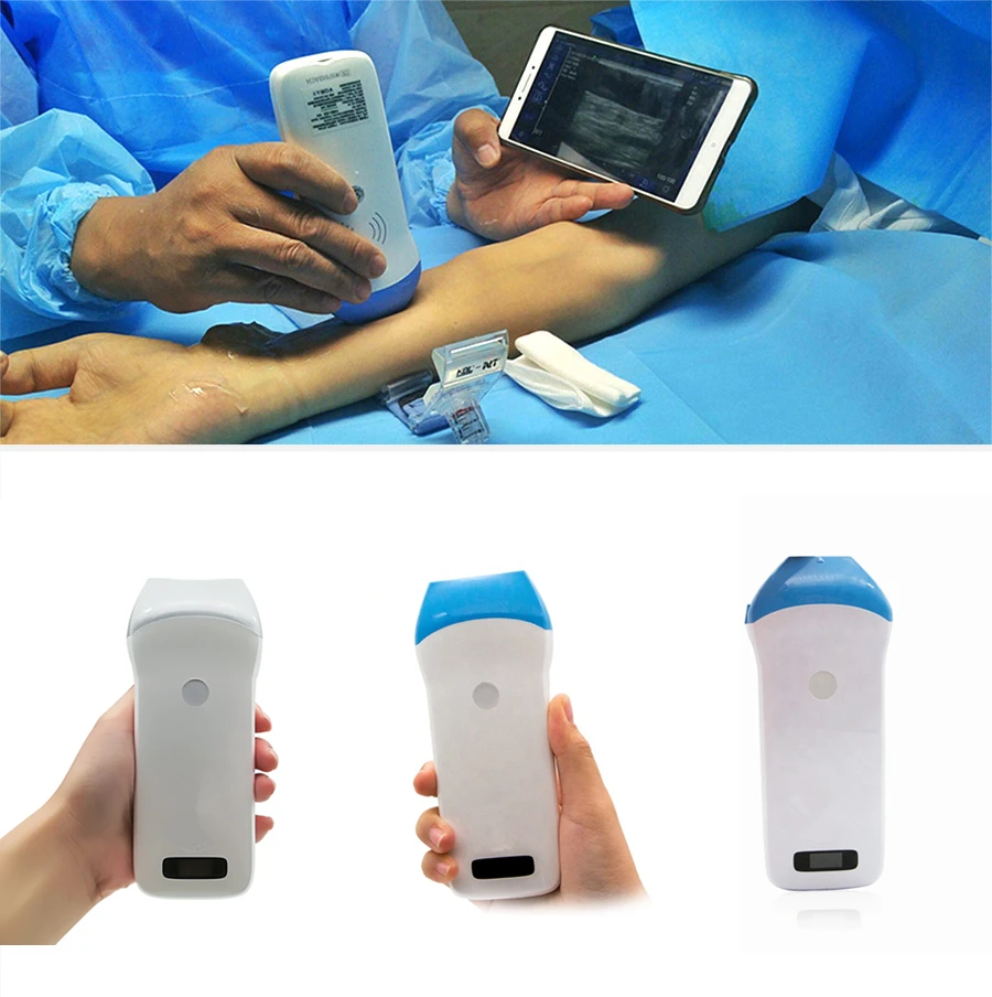 Sonostar Handhed 7.5MHZ 10MHZ 14MHZ 80E/128E Elements Wifi Wireless Ultrasound Scanner Linear Probe