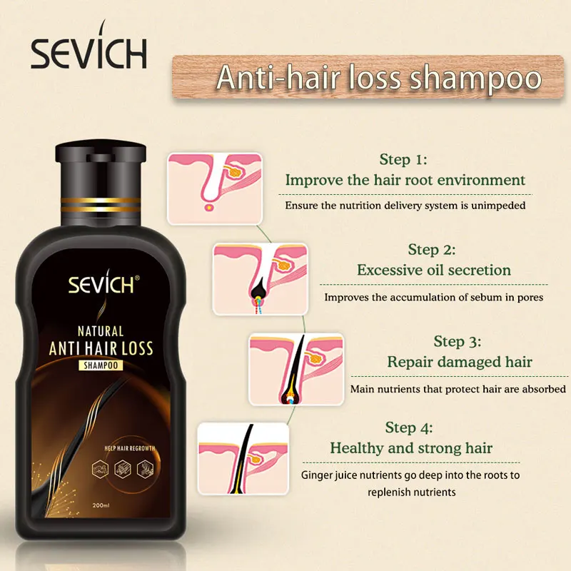 Sevich 200ml Anti Hair Loss Product Hair Loss Shampoo Natural With No Side Effects Grow Hair Faster Regrowth Hair Treatment