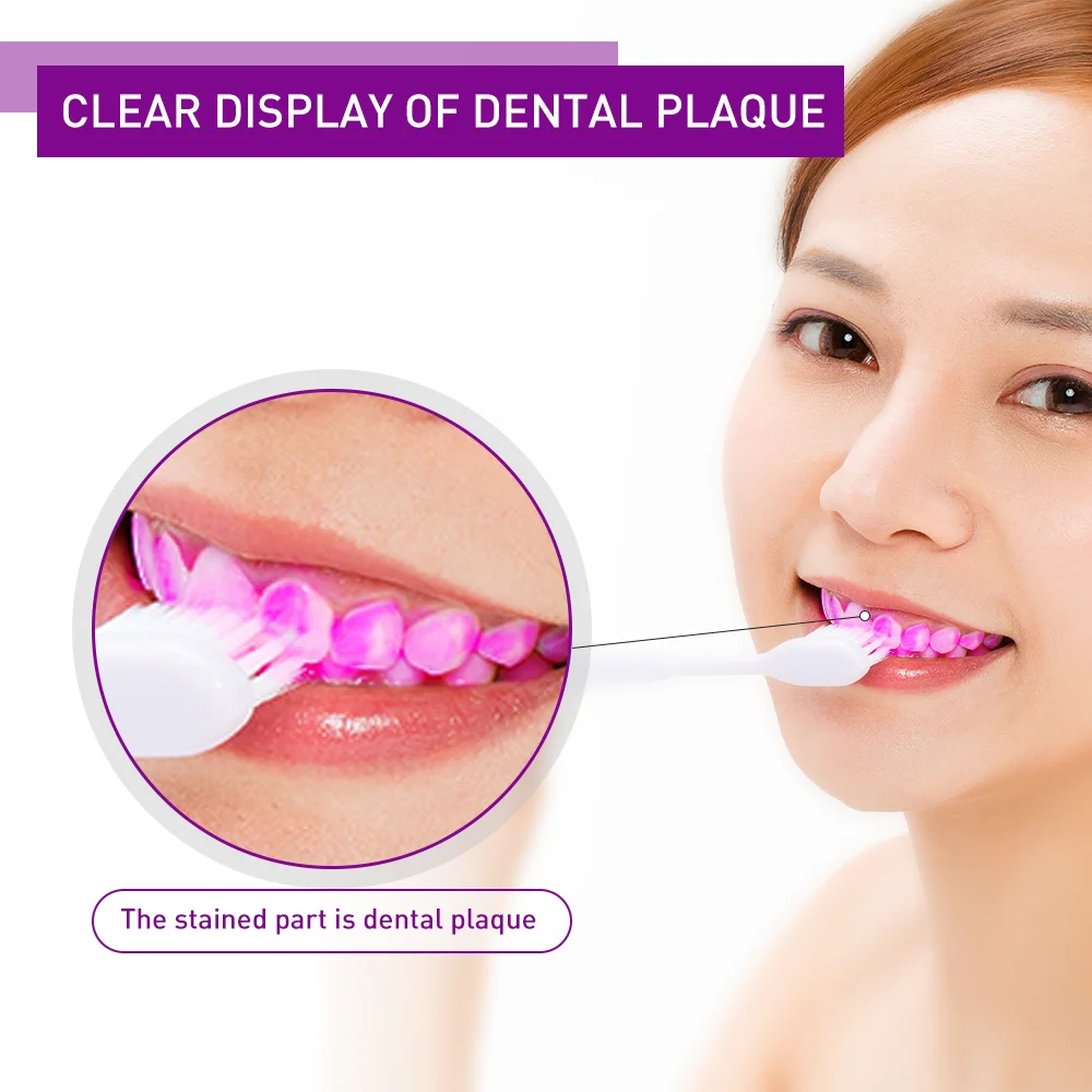 Y-kelin Dental Plaque Disclosing Tablet 72 Tabs (6 packs) Teeth Disclose Tooth Indicator Oral Hygiene