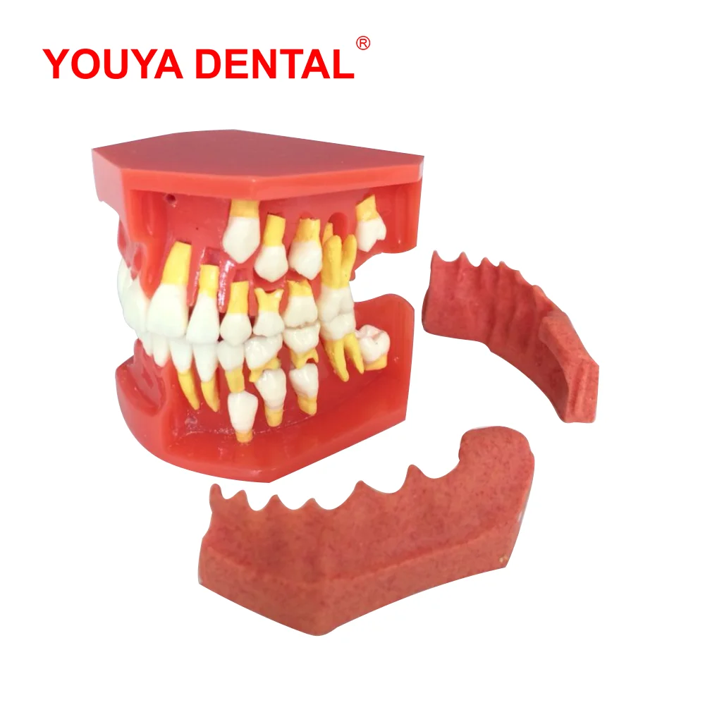 

Dental Model Resin Children Primary Permanent Tooth Model Alternative Deciduous Teeth Model For Studying Teaching Demonstration