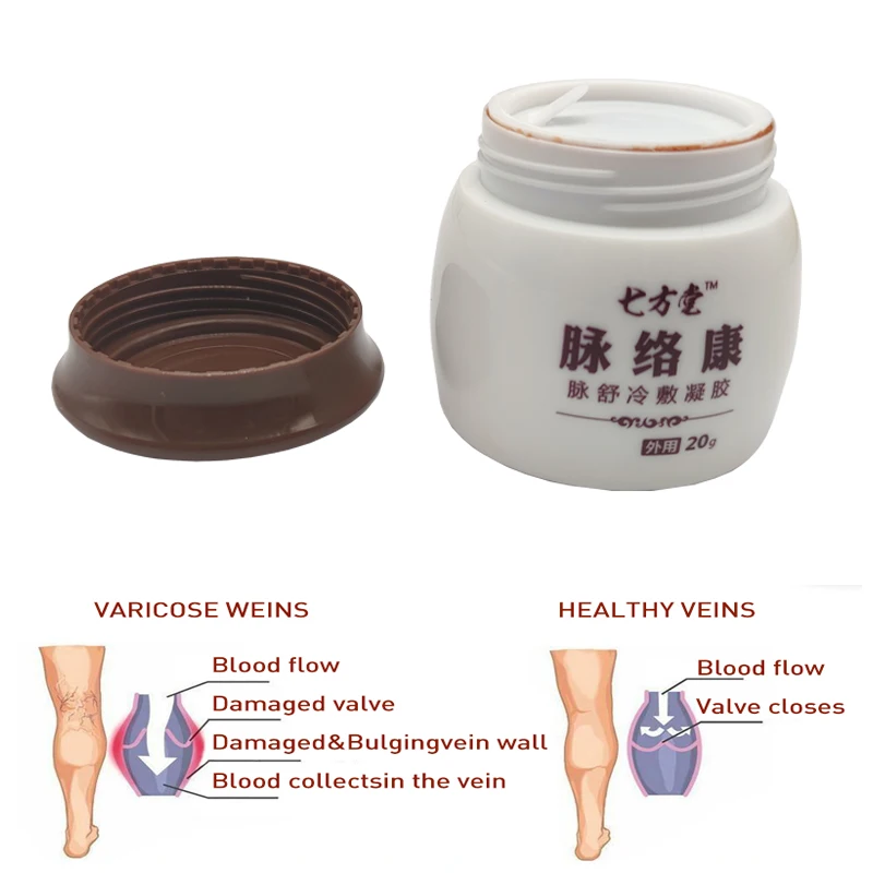 

Varicose Veins Treatment Cream Effective Cure Vasculitis Phlebitis Spider Veins Pain Varicosity Angiitis Ointment Health Care