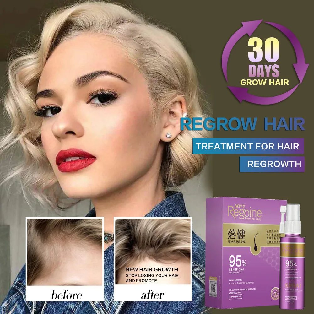 

Hair Growth Essence Oil Spray Fast Hair Growth Natural Anti Hair Loss Treatment Hair Solution Hair Care Products Hair Tonic