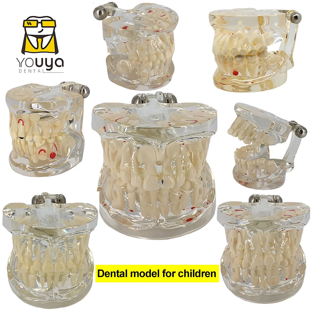 Dental Model For Children Deciduous Tooth Permanent Teeth Alternating Study Teathing Pediatric Dental Pathology Preventive Model