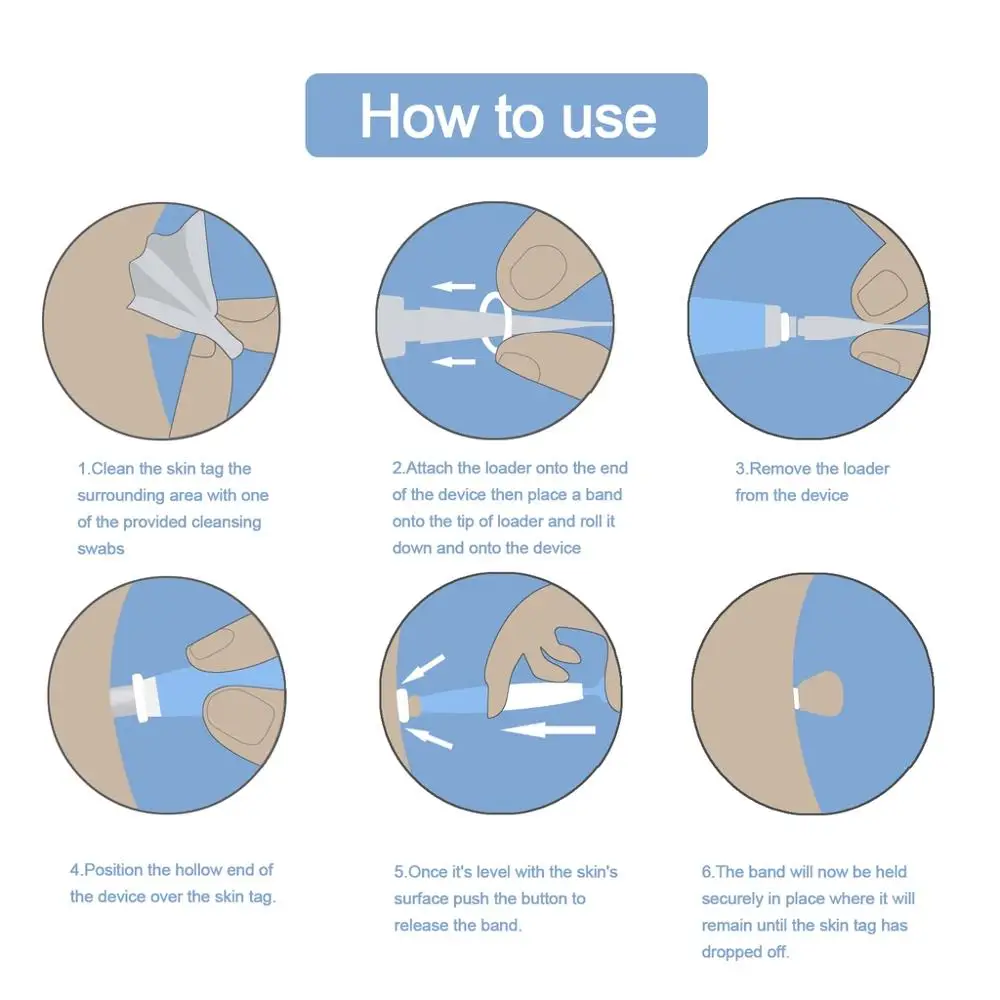 Lescolton Ⅱ Skin Tag Remover To Remover Wart Remover Mole Remover Skin Care Warts Removalผิวปานกลางหมวดหมู่BodyผลBand