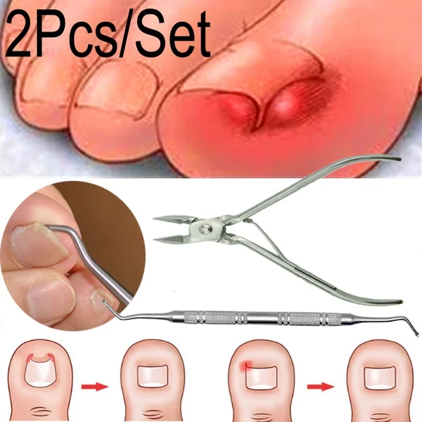 Pedicure tools professional ingrown Toe Nail Correction Nippers Clipper Cutter Dead Skin Dirt Remover + Paronychia Pedicure