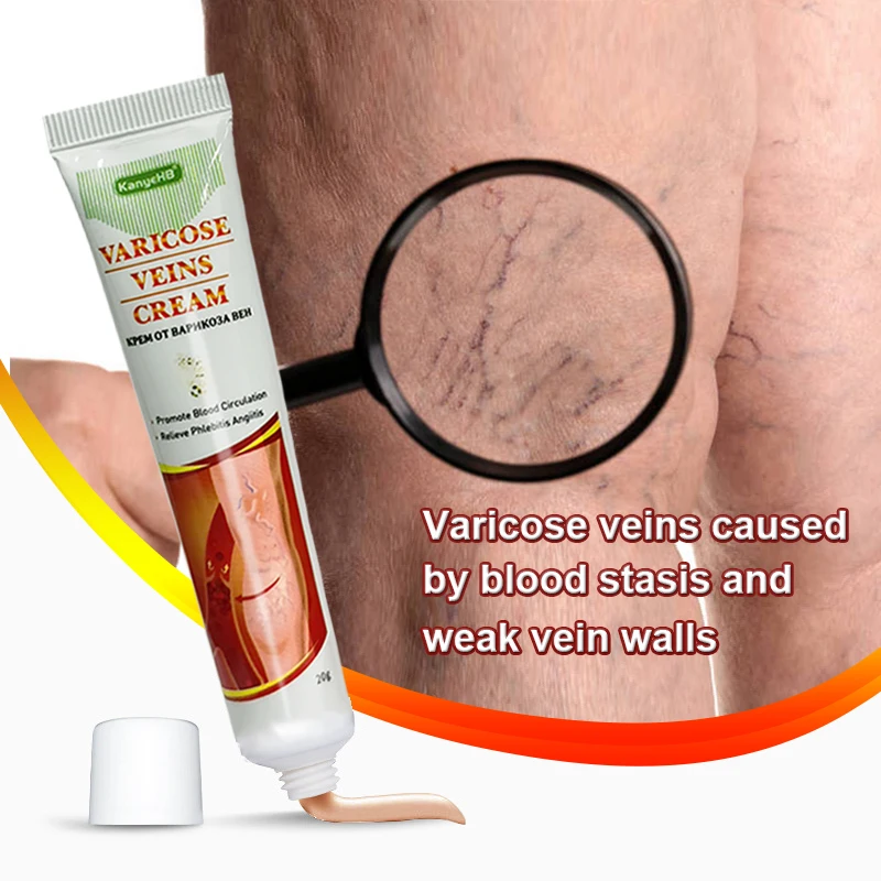 1Pcs Genital Varicose Vein Cream Vasculitis Phlebitis Varicocele Herbal Treatment Ointment Skin Care Relief Vein Swell Pain G002