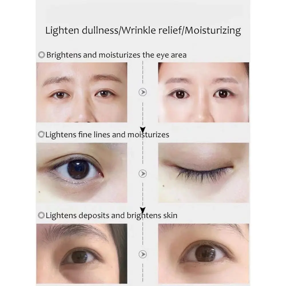 Muslimex six Peptide Electric Eye Cream radiazioni infrarosse Saccharomyces Bifidus Serum Eye Bags rassodante idratante Eye Care 50g