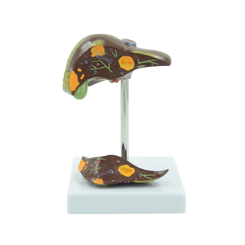 

Патологическая модель печени, 2 части, изучение заболеваний печени, научное оборудование