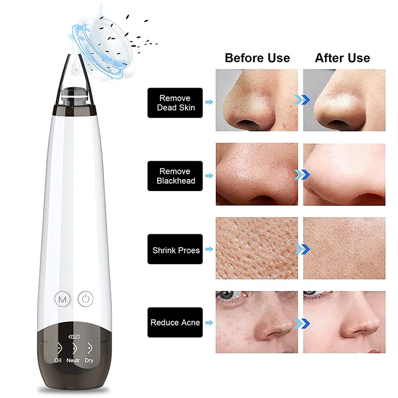 Blackhead Remover Pore Vacuum Facial Cleaner Electric Acne