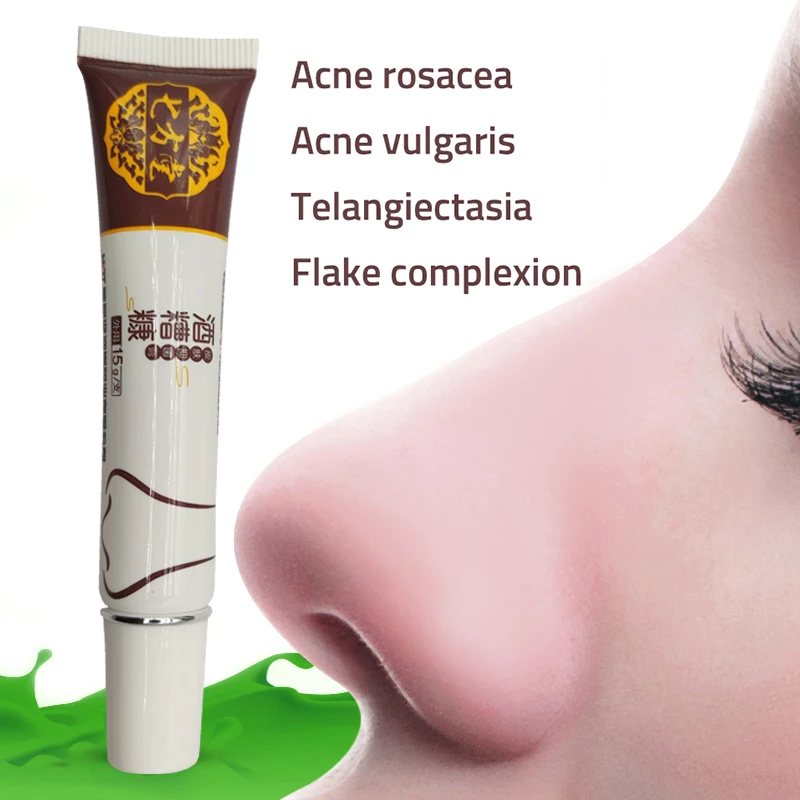 

Rosacea Repair Cream Remove Blackhead Acne Cream Skin Care Herbal Anti Acne And Mite Acne Red Nose Treat Shrink Pores Ointment