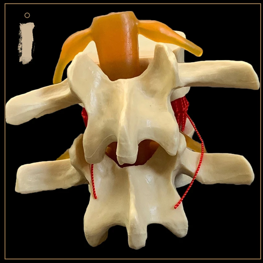 Vértebras Lombares Humanas Anatômicas, Disco Lombar Degenerativo, Herniation Demonstration Model, Modelo de Coluna Humana-Branco, Amarelo