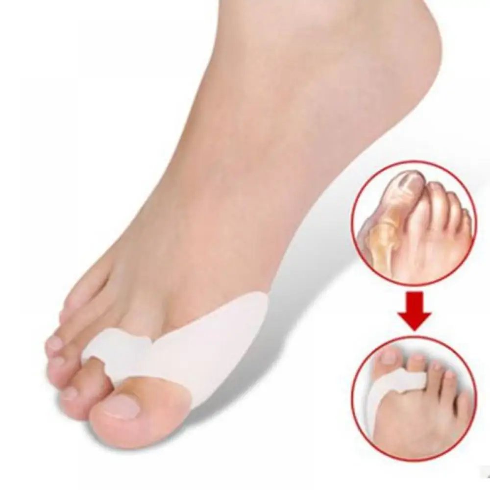 2Pcs Siliconen Gel Thumb Corrector Bunion Voet Teen Hallux Valgus Protector Separator Vinger Stijltang Richter Voetverzorging Tool