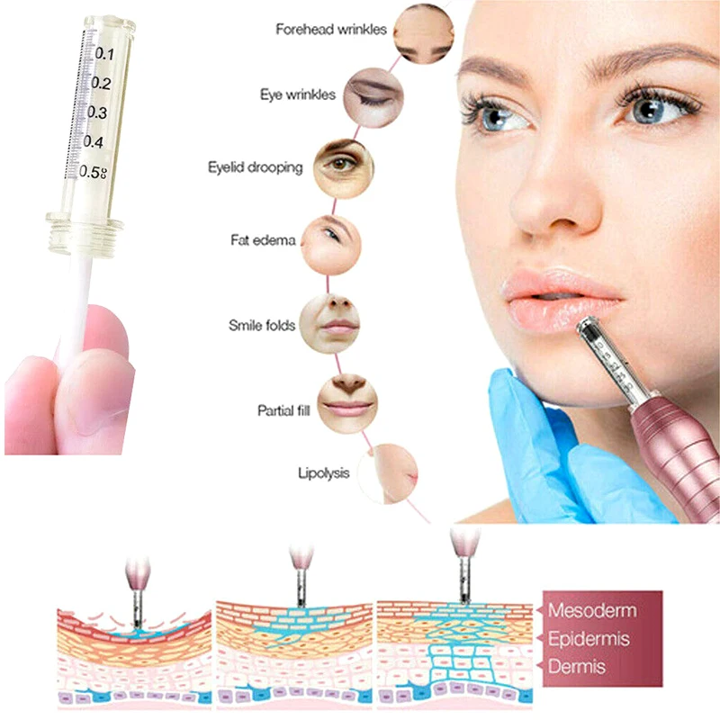 Ampolla de ácido hialurónico, jeringa para inyección de 0,5 ml de ácido hialurónico antiarrugas, pistola atomizadora, herramienta de pluma hialurón