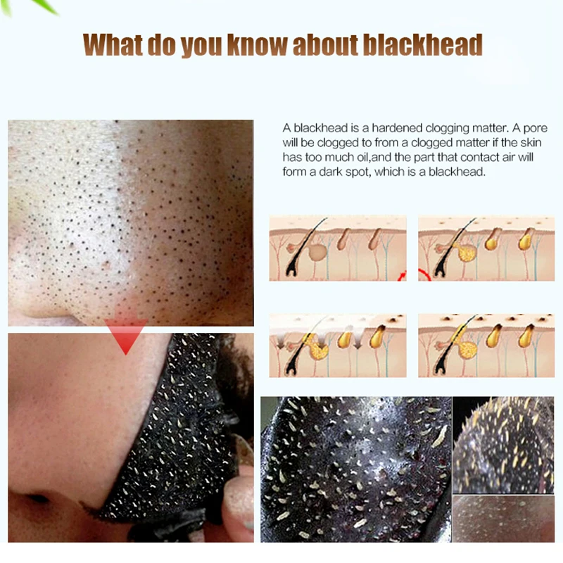 Blackhead Remover Mask Black Face Mask Acne Treatments Peel Off Black Mask From Black Dots Skin Care 3/5/6/10 packs