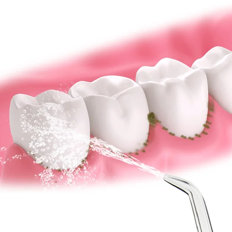 Pontas de jato clássicas para substituição, 3 pçs, adequado para irrigador oral à prova d\'água, estrutura de padrão para tamanhos coloridos