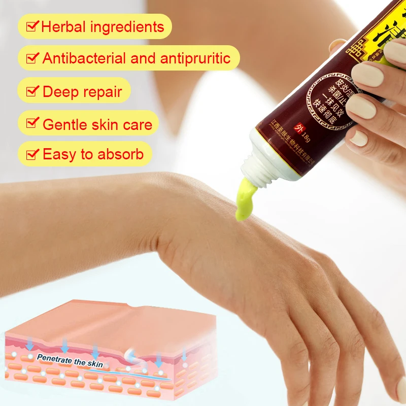 1pcs Itch Cream Unisex Remove Odor Antibacterial Pussy Intimate Deodorant Antipruritic Pruritus Dermatitis Rash Ointment S026