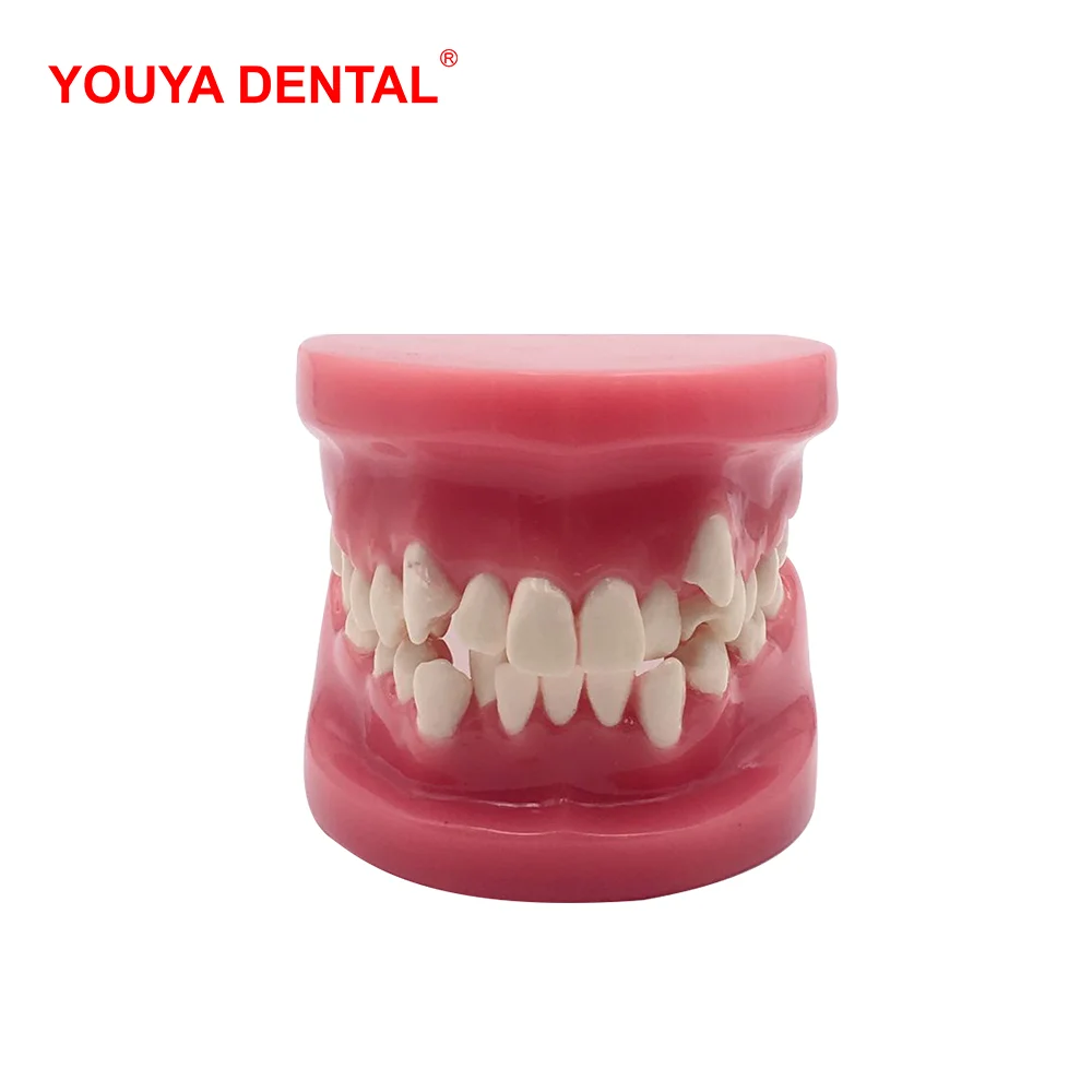 3D Resin Dental Model Teeth Malocclusion Model For Demostration Teaching Dentist Students Study Oral Medical  Dentistry Products