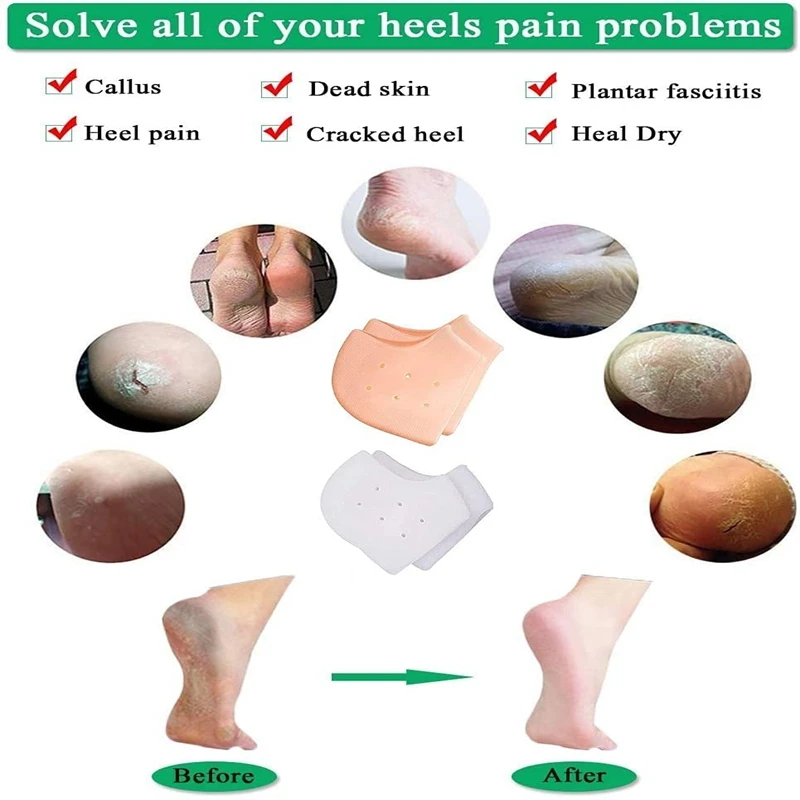 2Pcs Silicone Feet Care Socks Moisturizing Gel Heel Thin Socks with Hole Cracked Foot Skin Care Protectors Lace Heel Cover