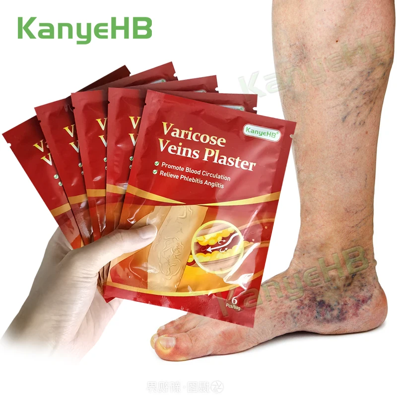 

24pcs/4bags Varicose Veins Plaster Traditional Medicine Vasculitis Phlebitis Cream Leg Medical Patch Angiitis Removal Patch A595