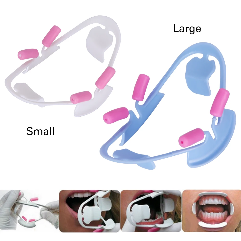 3D Oral Dental Mouth Opener Lip Retractor Orthodontic Professional Dentist Tools Dentistry Materials