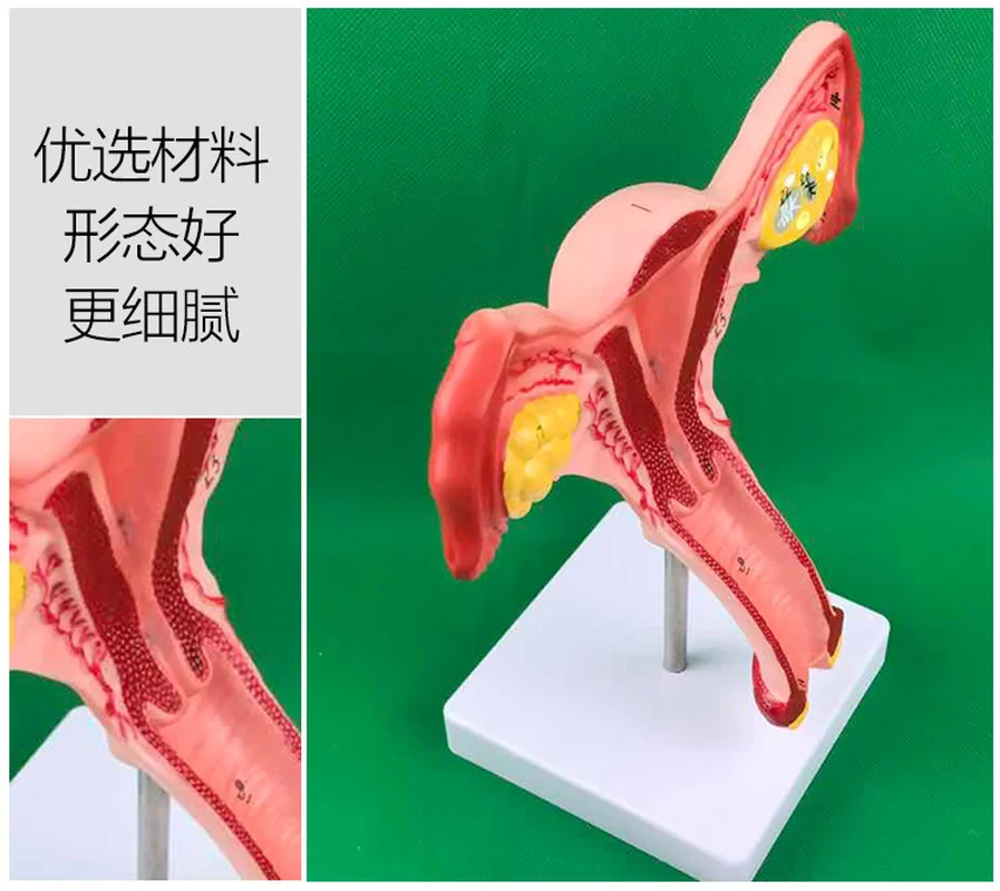 Ovary and uterus disease Dissection model Pathology Female uterus model teaching human medical aids anatomy lesion uterus