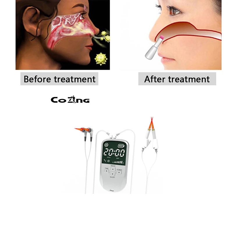 

Health Care Nase Rhinitis Sinusitis Nose Therapy Massage Device Cure Hay Fever Low Frequency Pulse Laser Therapentic Masseur