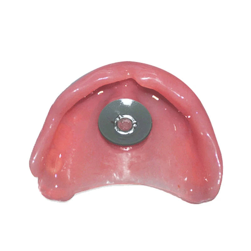 1Set Dental Lab Dental Sucker Denture Plate Retention For Full Upper Denture or Acrylic Partial Denture