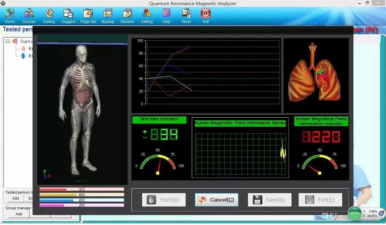 Quantum Therapy Analyzer 2024 New 62 Reports 6.3.36 Human Model 3 in 1 Magnetic Resonance Health Body Analysis Bio Resonant