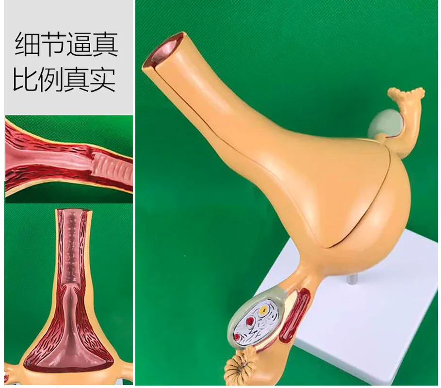 Ovary and uterus disease Dissection model Pathology Female uterus model teaching human medical aids anatomy lesion uterus