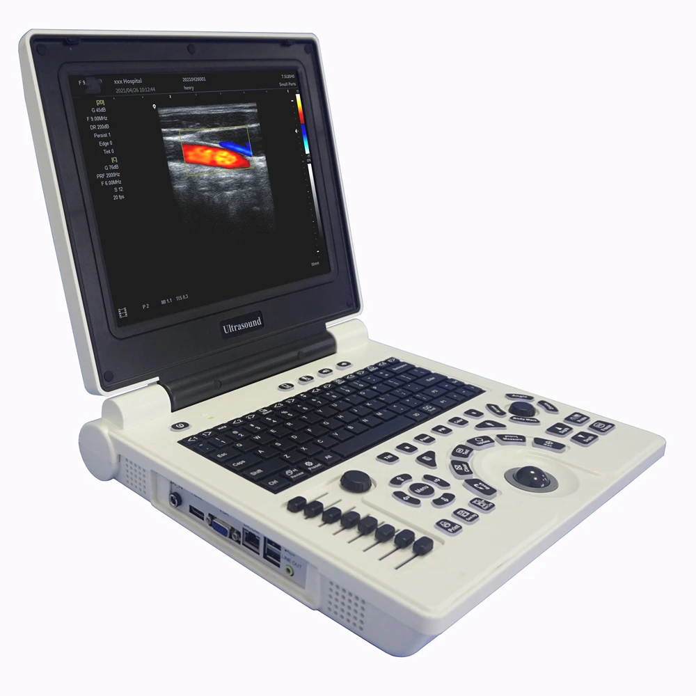 Economical 12inch Led Human Color Doppler Notebook Ultrasound Scanner Machine PC Based