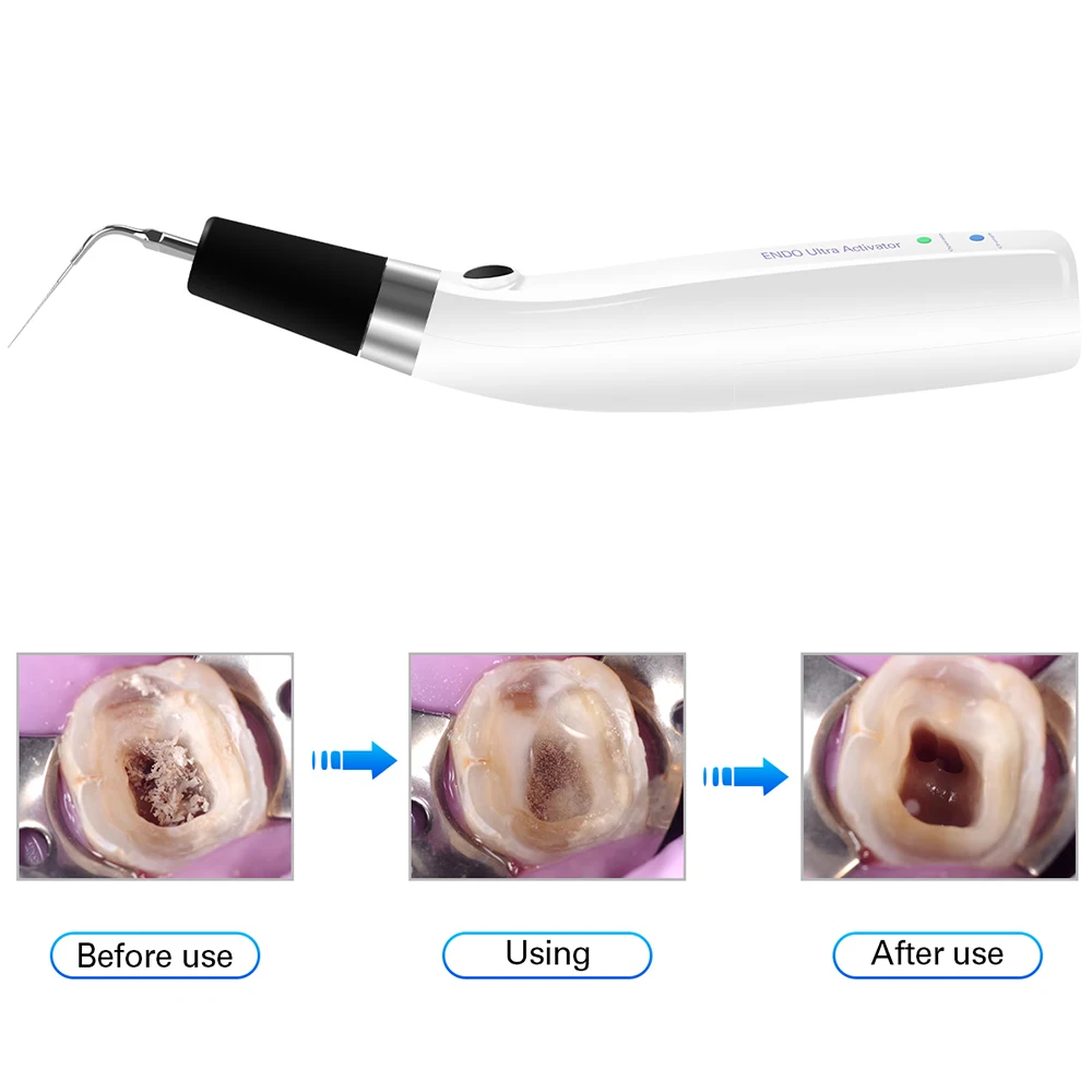 AZDENT Dental Endo Ultrasonic Activator 6 Tips Cordless Endodontic Irrigator Handpiece Root Canal Treatment Dentistry Instrument