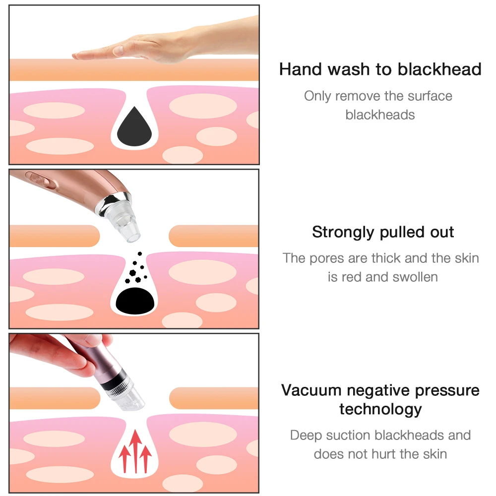 Appareil de beauté à petits moteurs, élimination des points noirs, aspiration sous vide, hydratant, micro bulle d'oxygène, pulvérisation d'injection, outils de soins de la peau